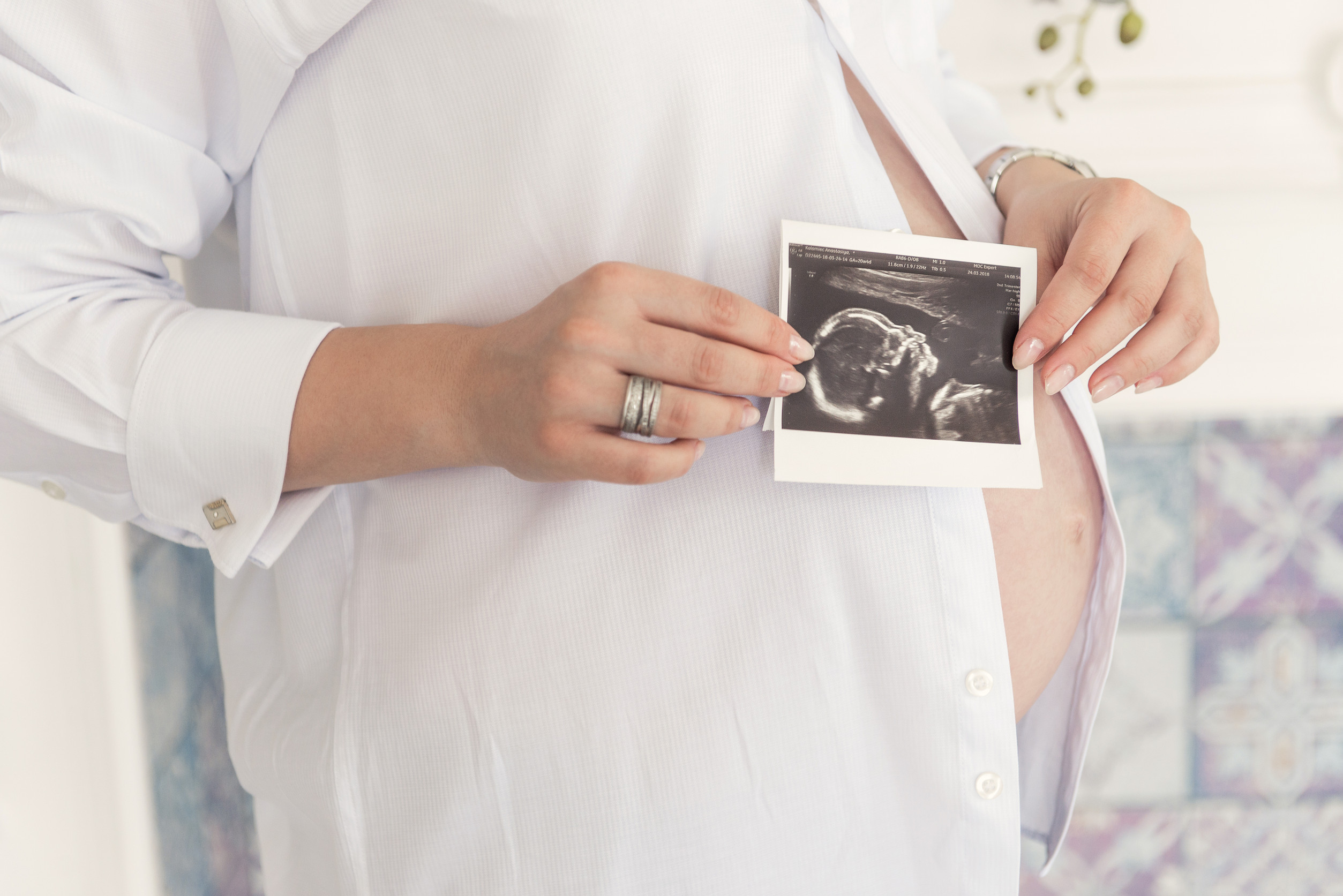 Tylenol pregnancy